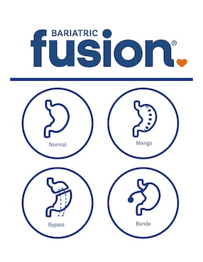 Multivitamin Bariatric Fusion de 180 Cápsulas