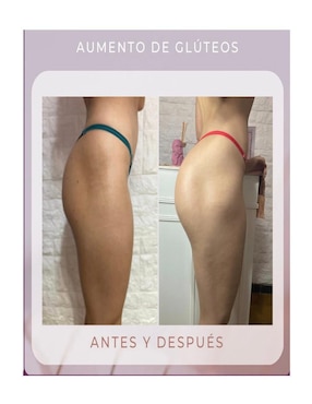 Lipoenzimas Natura con multivitaminico de 90 cápsulas