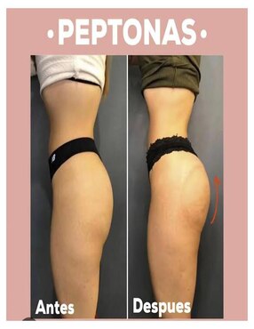 Kit de suplementos alimenticios Perfect Booty & Booty Woman Mesoestetic con vitaminas y minerales