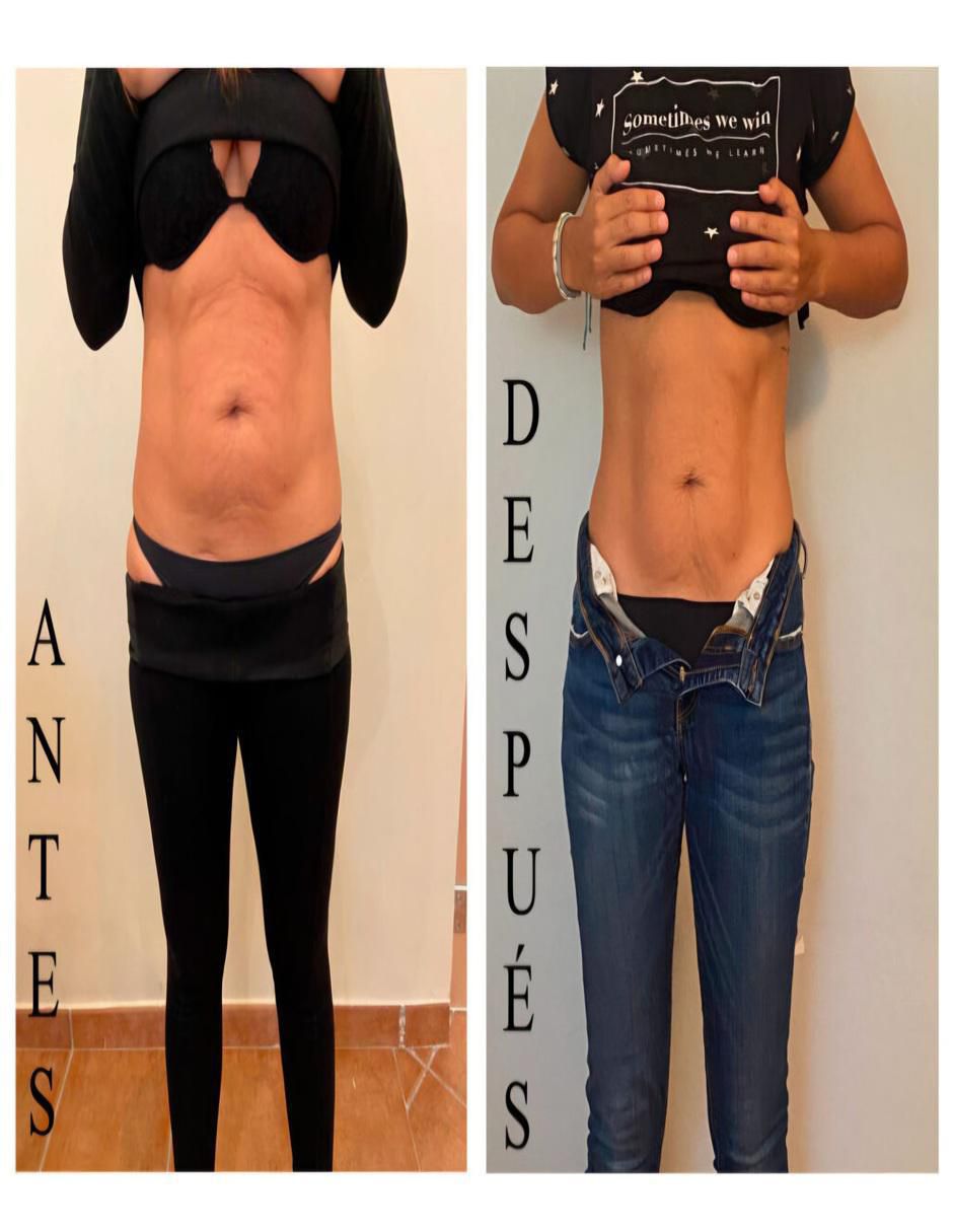 Set de suplementos alimenticios Reductor Abdominal con multivitaminico 2