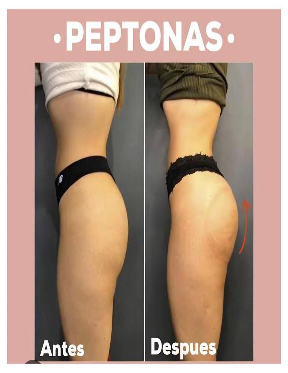 Kit de suplementos alimenticios Perfect Booty & Booty Woman con vitaminas y minerales 3